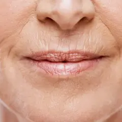 Zbliżenie na usta i nos kobiety. Widoczne głębokie zmarszczki nad ustami, świadczące o upływie czasu i bogatym życiu.