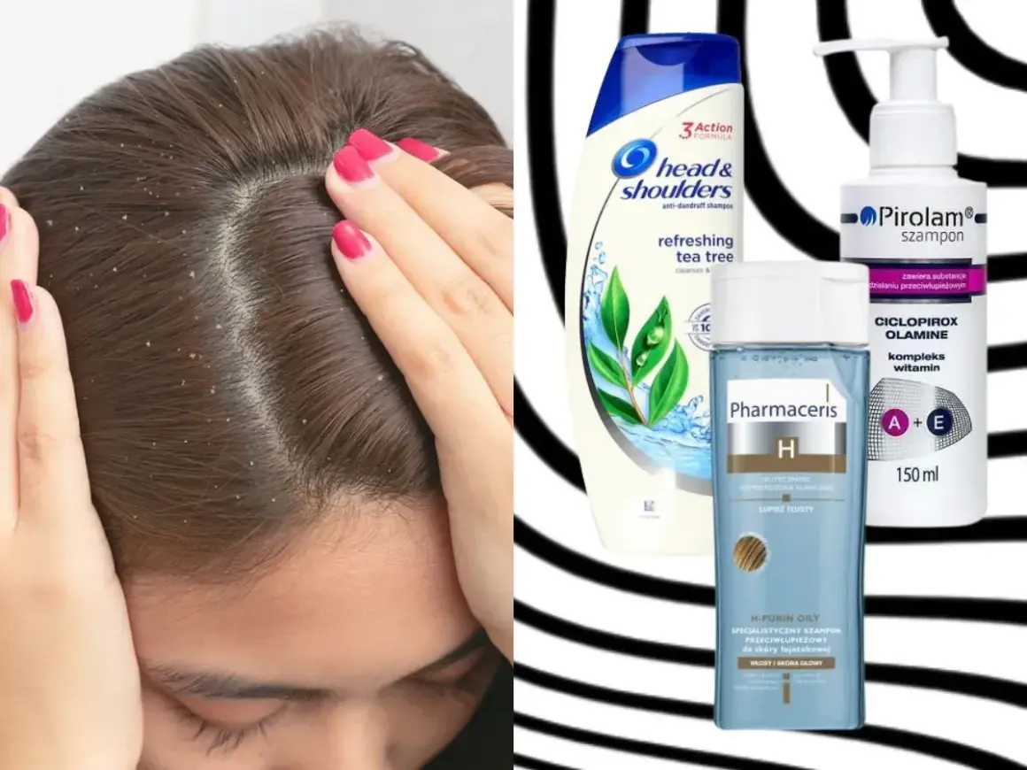 Łupież na głowie i szampony przeciwłupieżowe: Head & Shoulders, Pirolam, Pharmaceris. Co jest dobre na łupież?